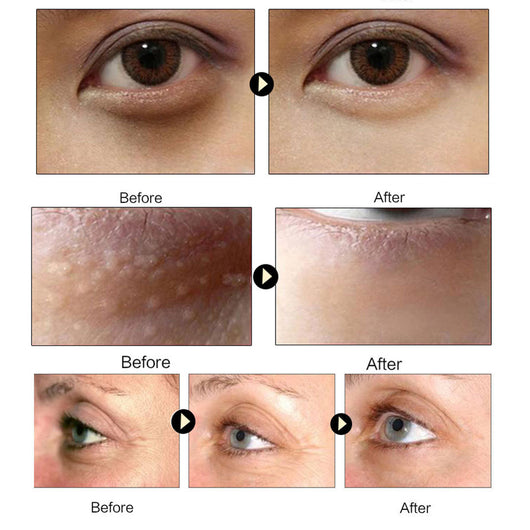 Mascarilla Contorno de Ojos con Colágeno y Oro - Image 10