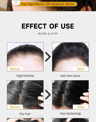 Biotina y Romero para Cabello Grueso y Voluminoso - Image 6