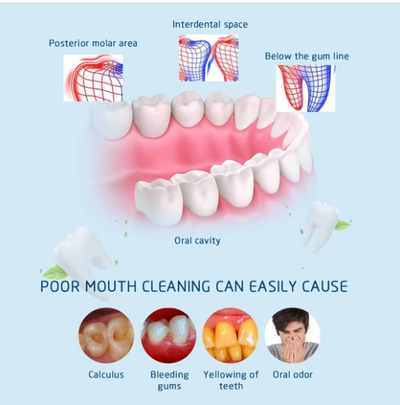 Removedor Ultrasónico de Sarro y Placa Dental - Image 11