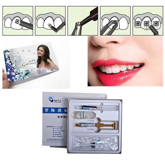 Adhesivo de Resina Fotopolimerizable para Ortodoncia