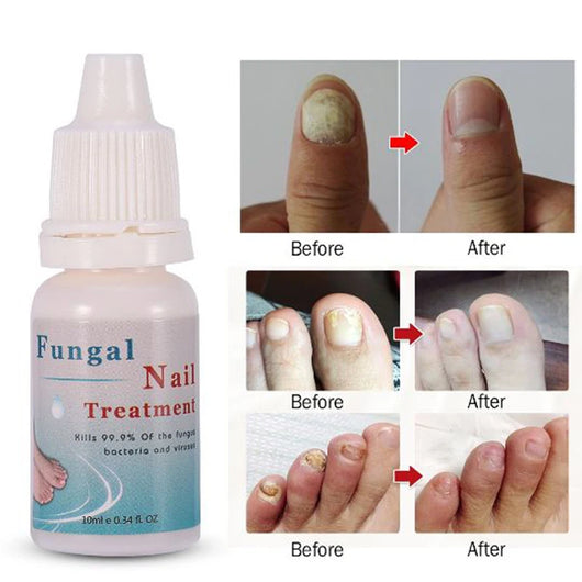 Líquido Reparador de Uñas 10ml - Tratamiento Nutritivo con Acción Esterilizante - Image 10