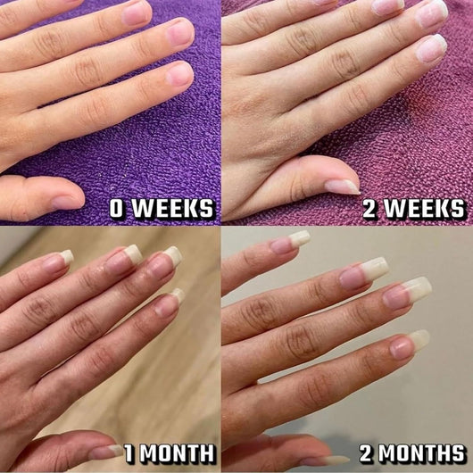Aceite Fortalecedor para Uñas - Crecimiento y Hidratación Intensiva - Image 5