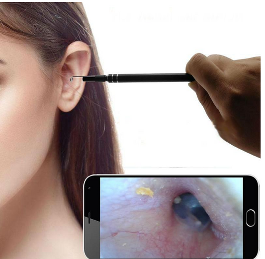 Otoscopio Endoscópico con Pinza de Extracción