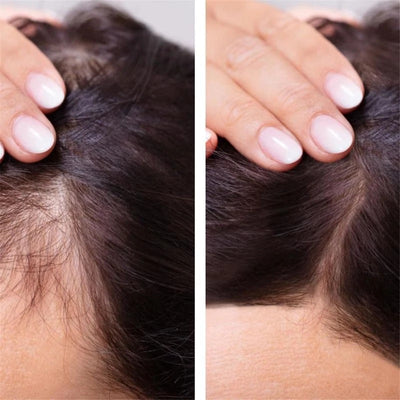 Solución Nutritiva para el Cabello con Jengibre - Image 4