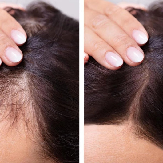 Solución Nutritiva para el Cabello con Jengibre - Image 4