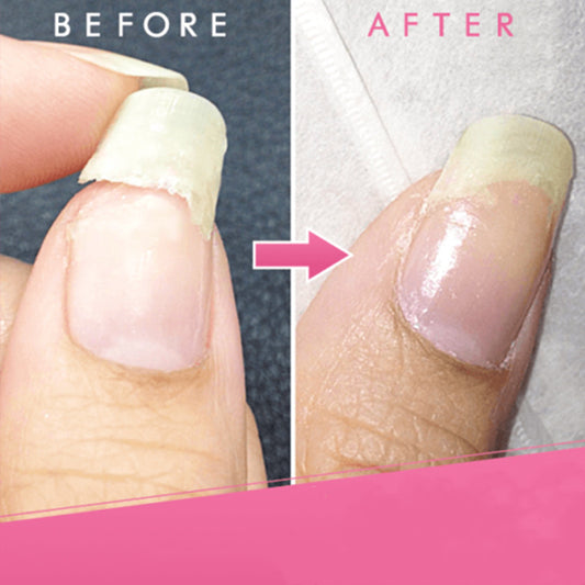 Adhesivo Reparador para Uñas Postizas - Image 2