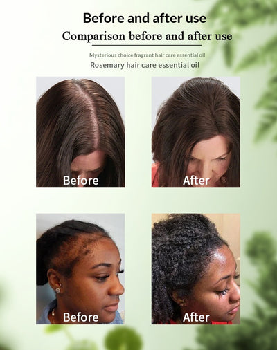 Aceite Esencial Nutritivo de Romero para el Cabello - Image 9