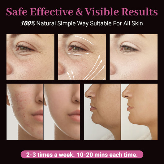 Varilla de Electroterapia con Ozono para Belleza Facial - Image 9