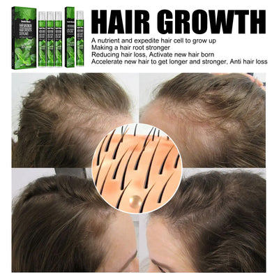 Spray Nutritivo para Crecimiento Capilar Mint Nutrition - Image 4