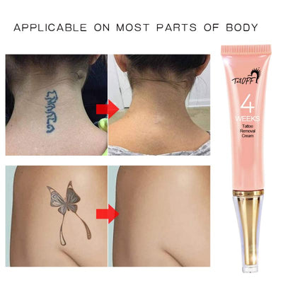 Crema Eliminadora de Tatuajes Máxima Potencia - Remoción Permanente sin Dolor - Image 7
