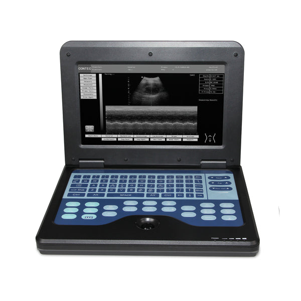 Ecógrafo Portátil Digital con Sonda Convexa 3.5 - Diagnóstico Profesional