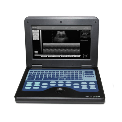 Ecógrafo Portátil Digital con Sonda Convexa 3.5 - Diagnóstico Profesional