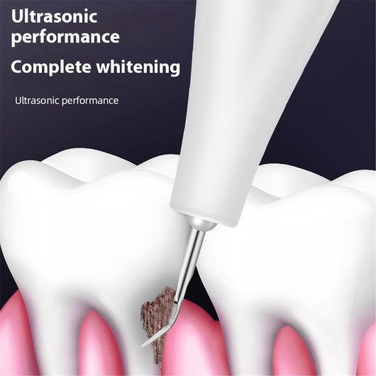 Removedor Ultrasónico de Sarro y Manchas Dentales Profesional - Image 2