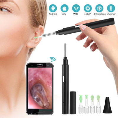 Otoscopio Visual HD con Endoscopio Inteligente para Limpieza de Cerumen - Image 11