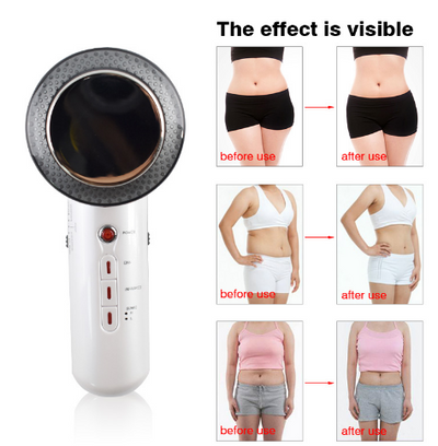 Masajeador Ultrasónico Reductivo Portátil para Eliminar Grasa Corporal - Image 5