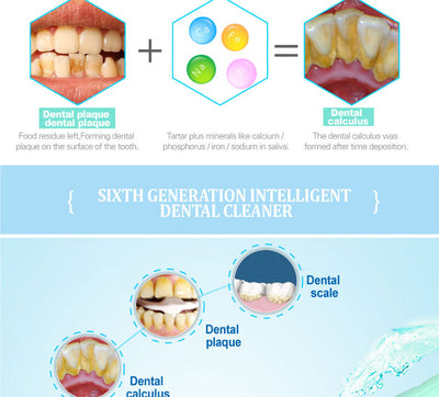 Limpiador Dental Ultrasónico Multifuncional - Image 5