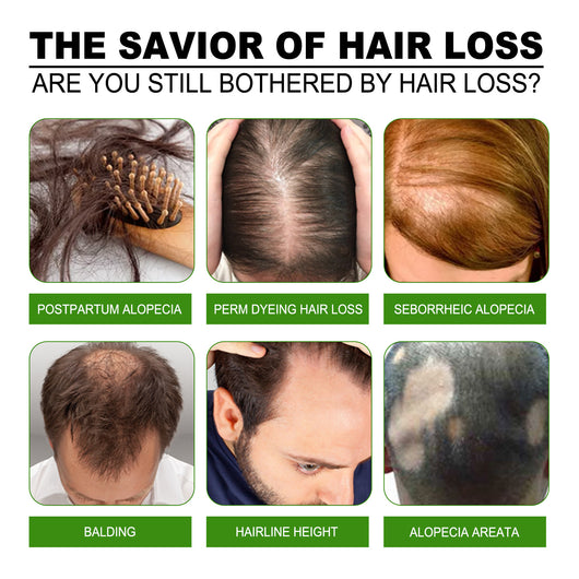 Solución Nutritiva para el Cabello con Jengibre - Image 16
