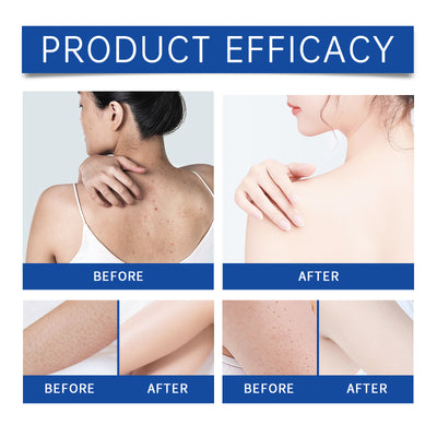 Aceite Esencial Masaje Facial Hidratante Iluminador - Cuidado Nutritivo Piel Sensible - Image 7