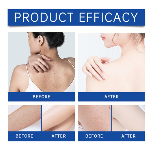 Aceite Esencial Masaje Facial Hidratante Iluminador - Cuidado Nutritivo Piel Sensible - Image 7
