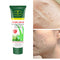 Gel Exfoliante Aichun - Limpieza Profunda