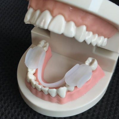 Protectores de Molares para Alineación Dental - Image 6