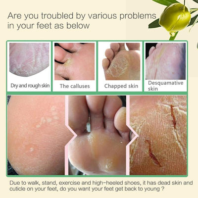 Mascarilla Exfoliante para Pies con Aloe Vera - Calcetines Peladores Regeneradores - Image 3