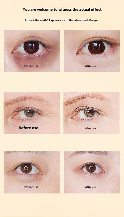 Aceite Esencial Lutein Dim para la Salud Visual - Image 19
