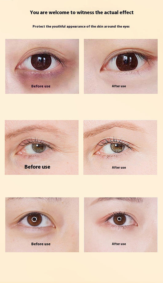 Aceite Esencial Lutein Dim para la Salud Visual - Image 19