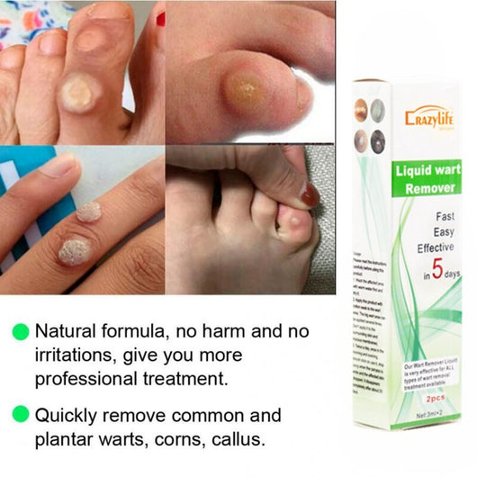 Bolígrafo Removedor de Verrugas Planas y Externas - Image 7