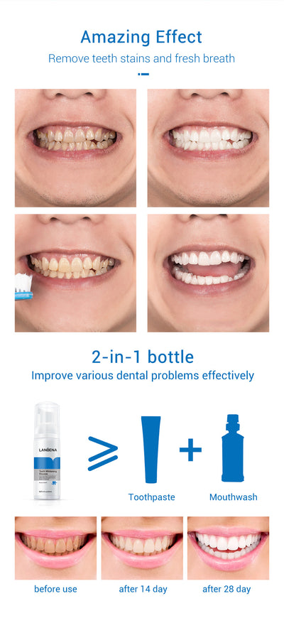 Agente Blanqueador Dental con Luz Azul LANBENA - Image 9