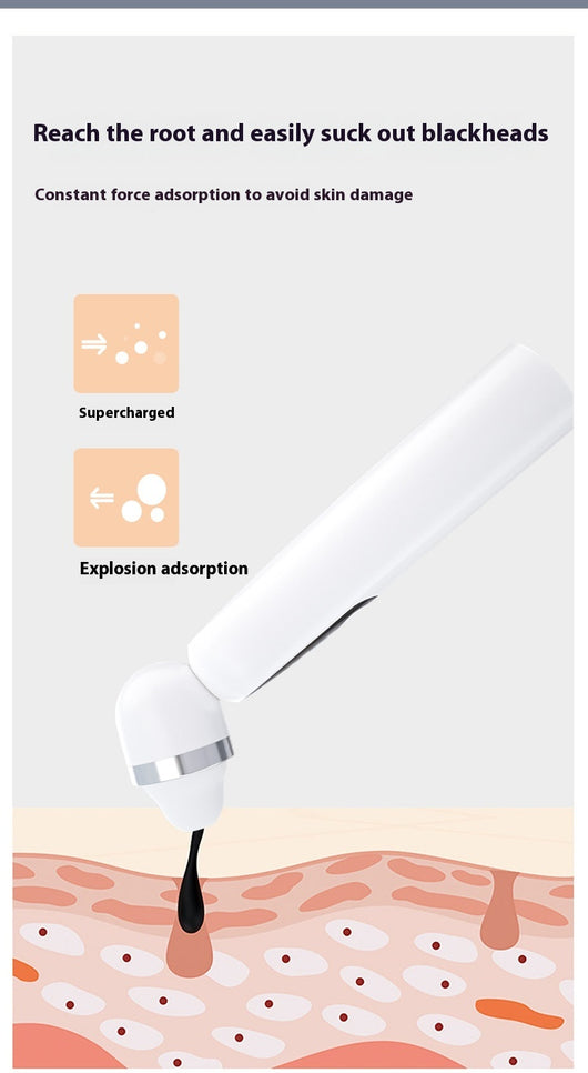 Dispositivo Limpiador de Poros con Visualización HD y Tecnología Ultrasónica - Image 7
