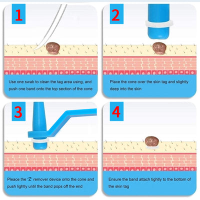 Parches para Uñas Encarnadas - Pack de 10 Tratamientos - Image 3