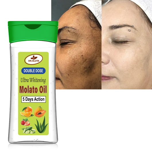 Aceite Corporal Molato Doble Potencia Blanqueador - Hidratación Intensiva 200ml - Image 5