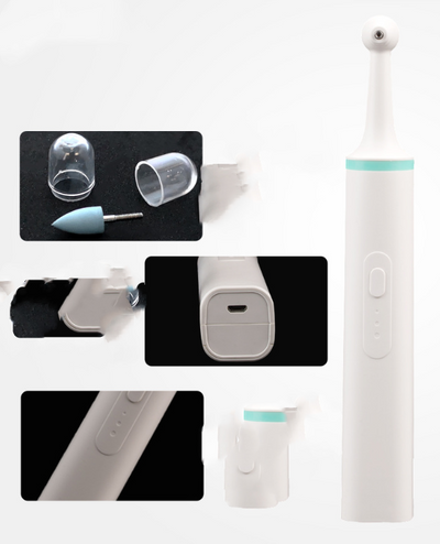 Limpiador Ultrasónico Dental Profesional con Tecnología de Blanqueamiento - Image 7