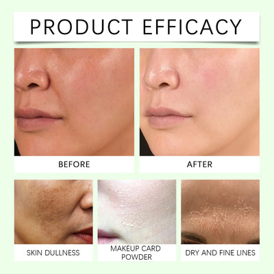Kit Facial Multiefecto Hidratante para Piel Suave, Lisa y Radiante - Image 11