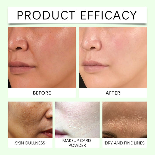 Kit Facial Multiefecto Hidratante para Piel Suave, Lisa y Radiante - Image 11