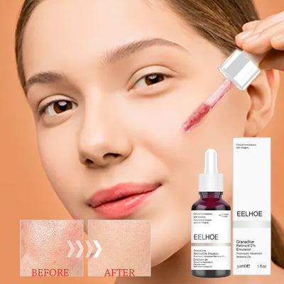 Sérum Refinator de Poros con Ácido Salicílico e Hidratación Profunda - Image 7