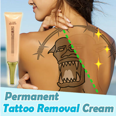 Crema Eliminadora de Tatuajes