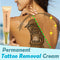 Crema Eliminadora de Tatuajes