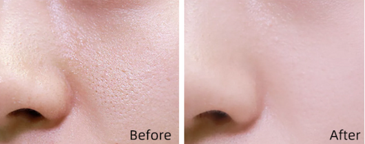 Corrector Impecable Meiqian - Cobertura Total para Manchas y Tatuajes - Image 13