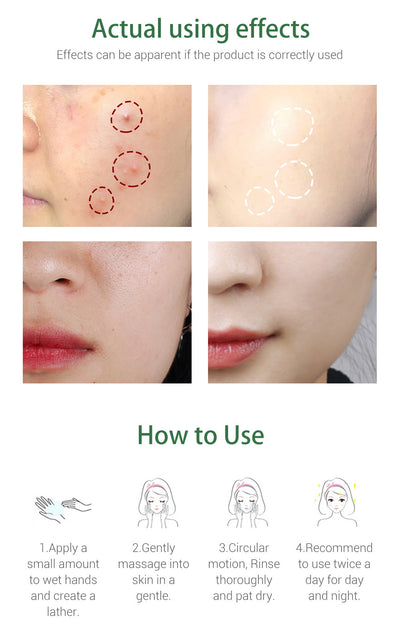 Limpiador Facial con Árbol de Té Breylee - Purificante Profundo - Image 10