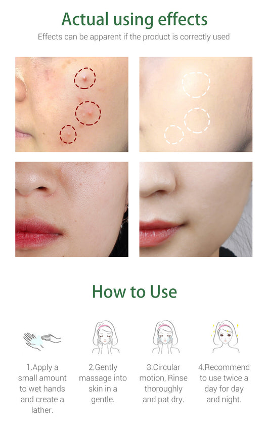Limpiador Facial con Árbol de Té Breylee - Purificante Profundo - Image 10