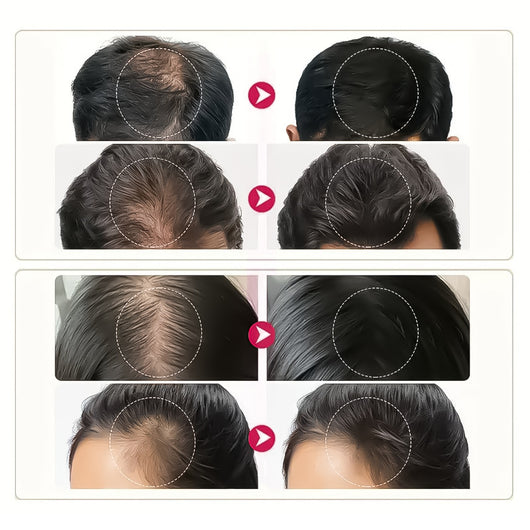 Solución Colágen para el Crecimiento del Cabello - Image 4