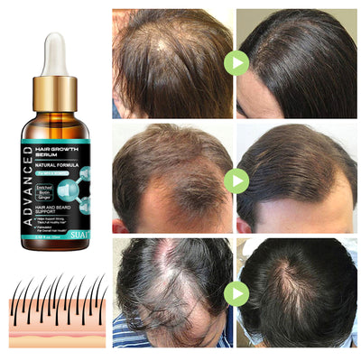 Solución Nutritiva para el Cabello con Jengibre - Image 2