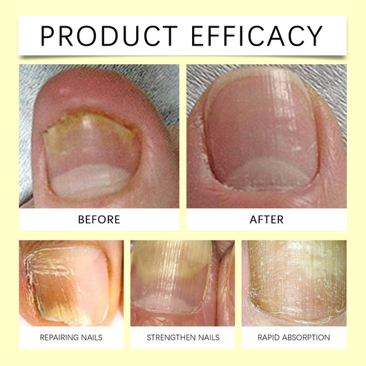 Aceite Reparador de Cutículas para Manos y Pies - Image 10
