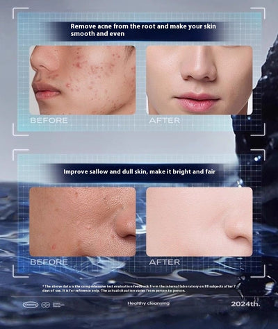 Limpiador Facial Antibacterial Regulador de Grasa y Eliminador de Puntos Negros para Hombres - Image 24