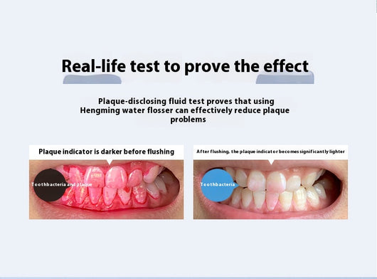 Irrigador Bucal Portátil - Removedor de Sarro Dental Eléctrico - Image 5