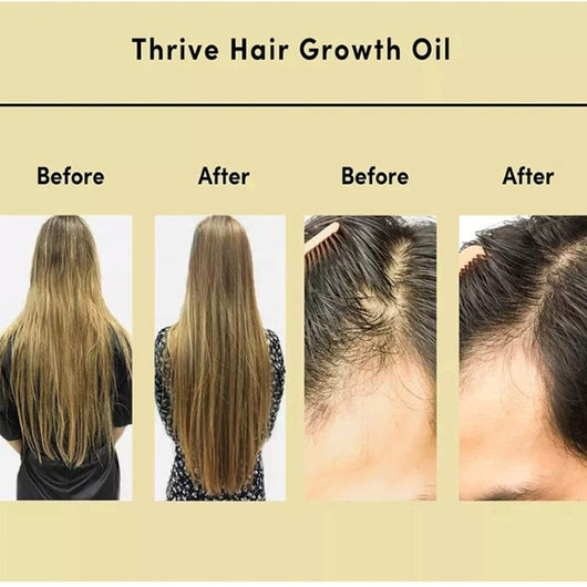 Aceite Esencial Nutritivo de Romero para Cabello Suave - Image 9