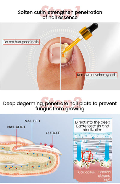 Solución Integral para Hongos en Uñas - Aceite Esencial Esterilizante - Image 12