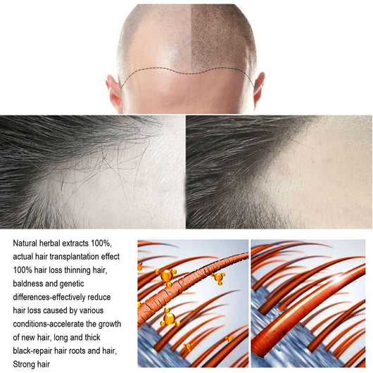 Solución Nutritiva para el Cabello con Jengibre - Image 13
